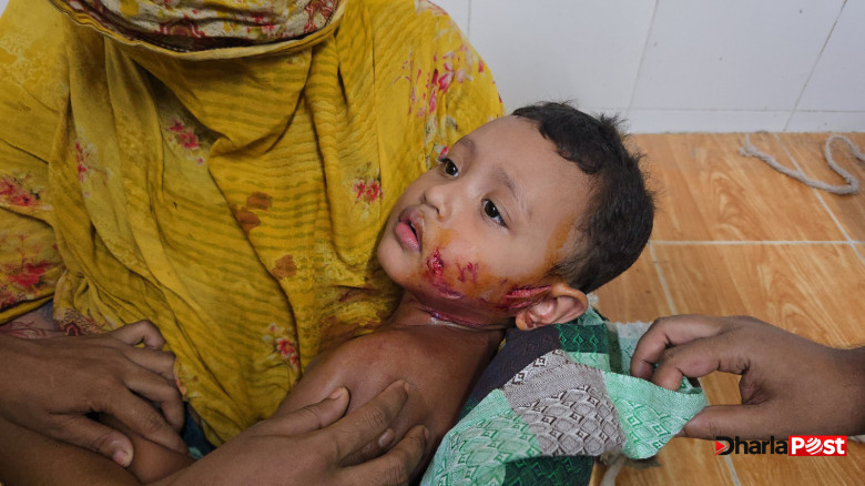পাবনায় পাগলা শিয়ালের তাণ্ডব, নারী-শিশুসহ আহত ১১
